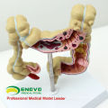 INTESTINE01 (12533) Modelo anatômico dos intestinos da ciência médica